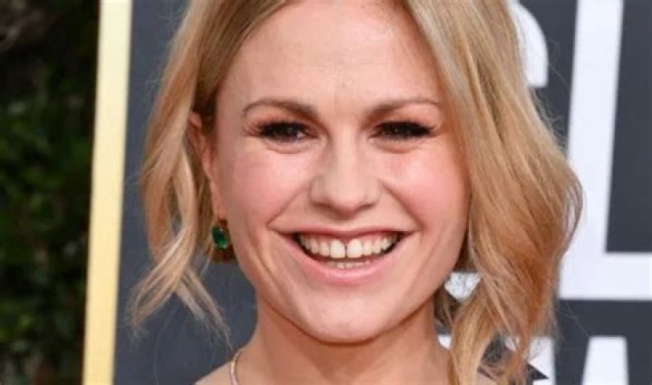 anna paquin teeth